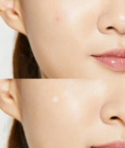 Cosrx Acne Pimple Master Patch 24pcs -Clore Beauty Store C00011524 3